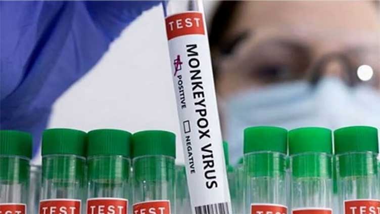 Sindh reports first Monkeypox case